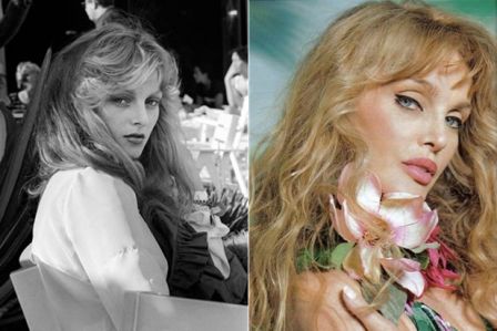 Arielle Dombasle chirurgie esthetique