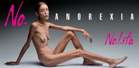 toscani contre l'anorexie